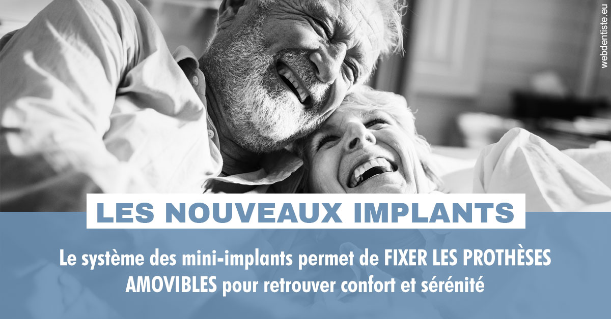 https://www.clinilac.ch/Les nouveaux implants 2