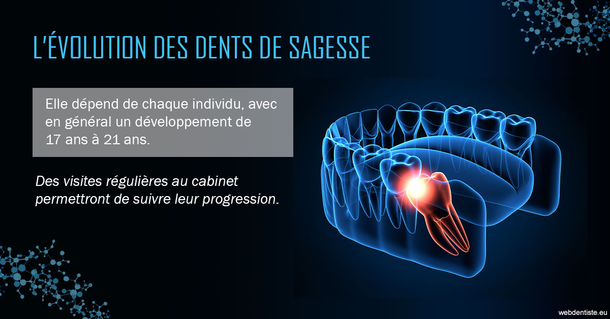 https://www.clinilac.ch/2023 T4 - Dents de sagesse 01