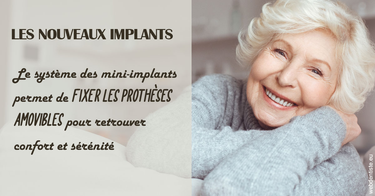 https://www.clinilac.ch/Les nouveaux implants 1