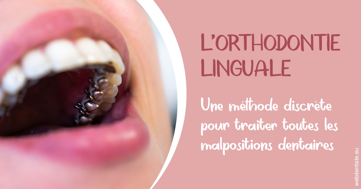 https://www.clinilac.ch/L'orthodontie linguale 2