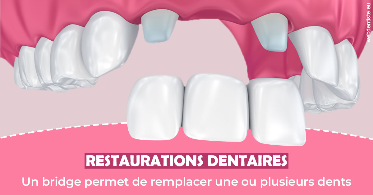 https://www.clinilac.ch/Bridge remplacer dents 2