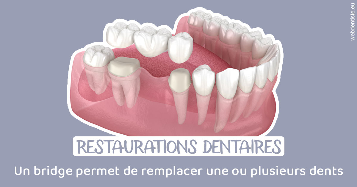 https://www.clinilac.ch/Bridge remplacer dents 1