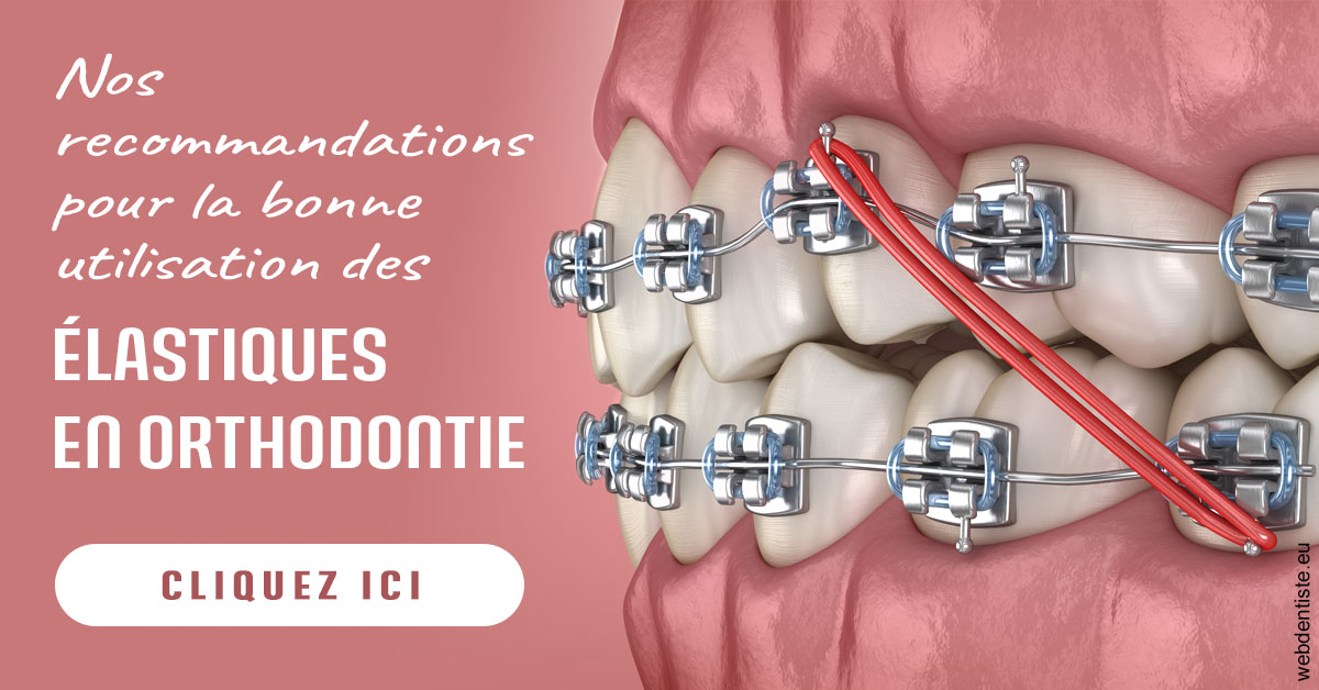 https://www.clinilac.ch/Elastiques orthodontie 2